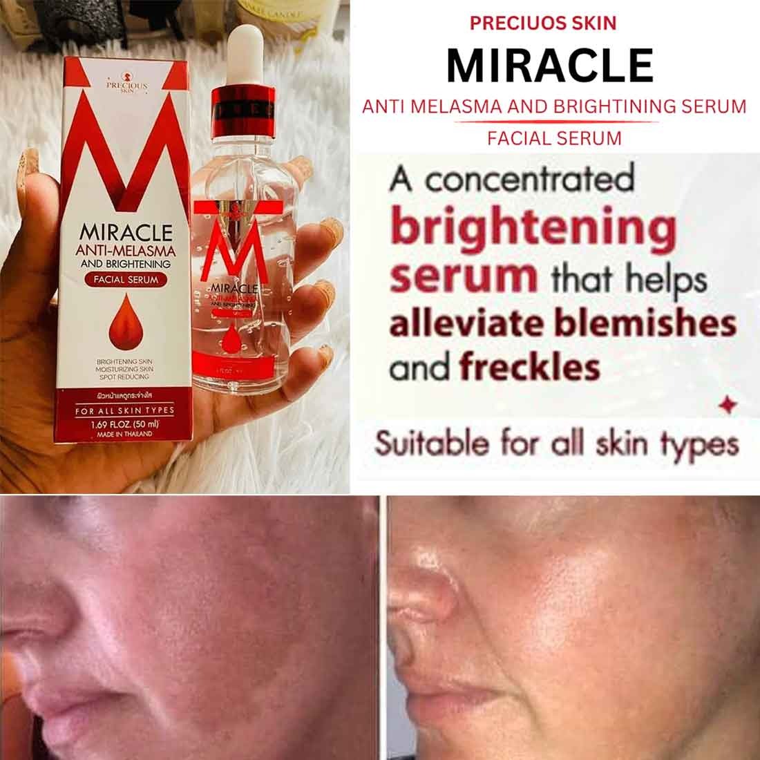 Miracle Anti-Melasma and Brightening Facial Serum